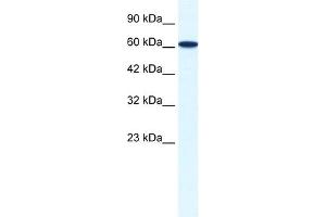 WB Suggested Anti-ZNF266 Antibody Titration:  0. (ZNF266 Antikörper  (N-Term))