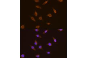 Immunofluorescence analysis of L929 cells using TSG101 antibody  at dilution of 1:100. (TSG101 Antikörper  (C-Term))