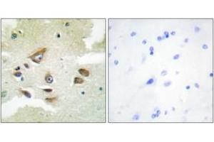 Immunohistochemistry analysis of paraffin-embedded human brain, using CLUS Antibody. (Clusterin Antikörper  (AA 400-449))