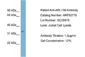 WB Suggested Anti-ARL13B  Antibody Titration: 0. (ARL13B Antikörper  (Middle Region))