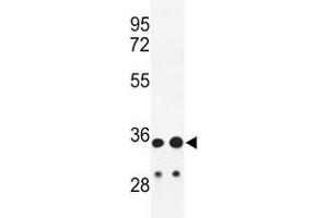 Western blot analysis of IGH antibody and HL-60, A2058 lysate. (IgH Antikörper  (AA 290-320))