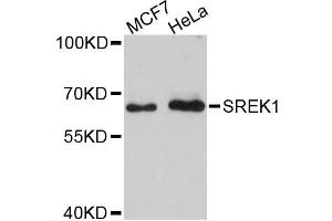 Western blot analysis of extracts of various cell lines, using SREK1 antibody. (SFRS12 Antikörper)