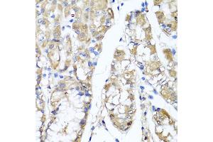 Immunohistochemistry of paraffin-embedded human stomach using TNFAIP6 antibody (ABIN5975410) at dilution of 1/100 (40x lens). (TNFAIP6 Antikörper)