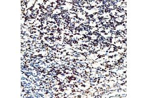 IHC analysis of CD5 using anti-CD5 antibody (ABIN5693203).