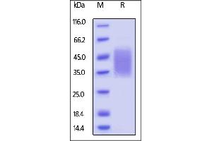 SDS-PAGE (SDS) image for CD47 (CD47) (AA 19-141) (Active) protein (His tag) (ABIN5674615)
