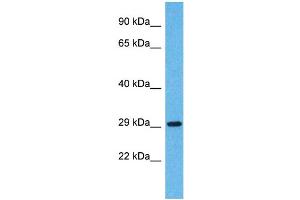 Western Blotting (WB) image for anti-Olfactory Receptor, Family 5, Subfamily H, Member 14 (OR5H14) (C-Term) antibody (ABIN2791756) (OR5H14 Antikörper  (C-Term))