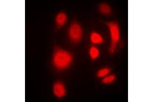 Immunofluorescent analysis of SGK1/2 (pT256/253) staining in HeLa cells. (SGK1/2 (pSer253), (pSer256) Antikörper)
