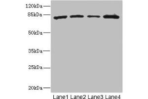 Western blot All lanes: ZP2 antibody at 3. (ZP2 Antikörper  (AA 651-745))