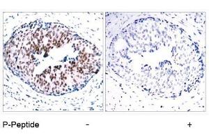 Image no. 1 for anti-Signal Transducer and Activator of Transcription 5A (STAT5A) (pSer780) antibody (ABIN196699) (STAT5A Antikörper  (pSer780))