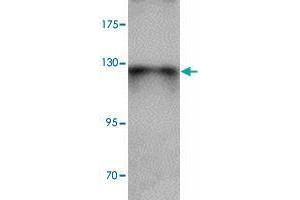 Western blot analysis of ZBTB4 in SK-N-SH cell lysate with ZBTB4 polyclonal antibody  at 1 ug/mL. (ZBTB4 Antikörper  (C-Term))