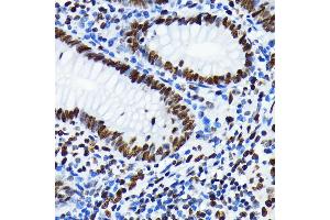 Immunohistochemistry (IHC) image for anti-Histone H4 (acLys5) antibody (ABIN7267743)