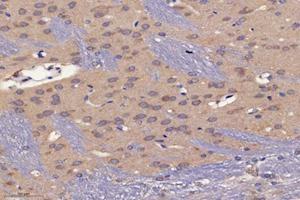 Immunohistochemistry (Paraffin-embedded Sections) (IHC (p)) image for anti-Proteasome (Prosome, Macropain) 26S Subunit, Non-ATPase, 8 (PSMD8) antibody (ABIN7075226)