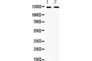Western blot analysis of CD11b expression in mouse brain extract ( Lane 1) and HEPA whole cell lysates ( Lane 1). (CD11b Antikörper  (AA 260-360))