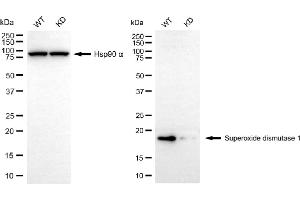 Western blotting analysis using superoxide dismutase 1 antibody (ABIN7800461).