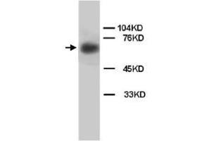 Western Blot analysis of LMNB1 expression from rat brain tissue lyate with LMNB1 polyclonal antibody . (Lamin B1 Antikörper  (C-Term))