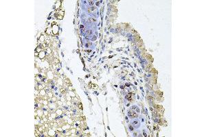 Immunohistochemistry of paraffin-embedded mouse lung using RHOT1 antibody at dilution of 1:100 (x40 lens). (RHOT1 Antikörper)