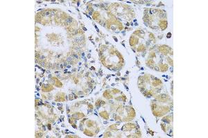 Immunohistochemistry of paraffin-embedded human stomach using PMPCB antibody (ABIN5972414) at dilution of 1/100 (40x lens). (PMPCB Antikörper)