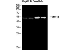 Western Blot (WB) analysis of HepG2 JK Colo HeLa using TRMT11 antibody. (Trmt11 Antikörper)