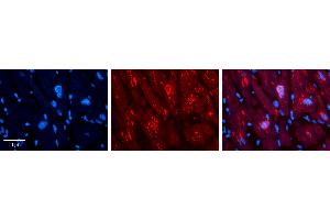 Rabbit Anti-MLX Antibody   Formalin Fixed Paraffin Embedded Tissue: Human heart Tissue Observed Staining: Cytoplasmic, nucleus Primary Antibody Concentration: N/A Other Working Concentrations: 1:600 Secondary Antibody: Donkey anti-Rabbit-Cy3 Secondary Antibody Concentration: 1:200 Magnification: 20X Exposure Time: 0. (MLX Antikörper  (C-Term))