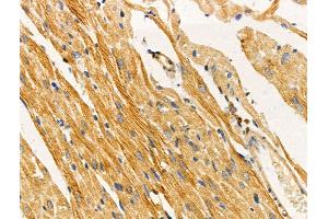 ABIN6258718 and ABIN6274421 at 1/100 staining Rat heart tissue by IHC-P. (TUSC5 Antikörper  (N-Term))