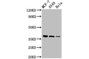 Western Blot Positive WB detected in: MCF-7 whole cell lysate, A549 whole cell lysate, Hela whole cell lysate All lanes: TMEM59 antibody at 3 μg/mL Secondary Goat polyclonal to rabbit IgG at 1/50000 dilution Predicted band size: 37 kDa Observed band size: 37 kDa (TMEM59 Antikörper  (AA 59-201))