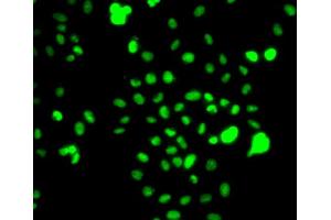 Immunofluorescence analysis of MCF7 cell using CEBPG antibody. (CEBPG Antikörper)