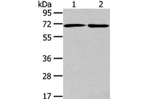 Western Blot analysis of A431 and hela cell using ARFGAP2 Polyclonal Antibody at dilution of 1/200 (arfgap2 Antikörper)