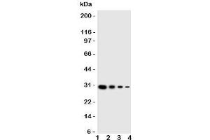 Western blot testing of LTK antibody and human recombinant protein;  Lane 1: 10ng;   2: 5ng;  3: 2.