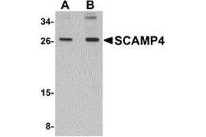 Western Blotting (WB) image for anti-Secretory Carrier Membrane Protein 4 (SCAMP4) (C-Term) antibody (ABIN1030644)