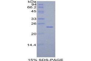 SDS-PAGE (SDS) image for TIMP Metallopeptidase Inhibitor 4 (TIMP4) (AA 40-224) protein (His tag) (ABIN2122238)