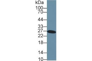 Western Blot; Sample: Human Liver lysate; Primary Ab: 2µg/ml Rabbit Anti-Human GSTa3 Antibody Second Ab: 0. (GSTA3 Antikörper  (AA 1-222))