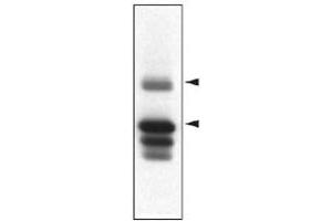 Western blot analysis of Ptpn5 in striatal rat protein homogenates using Ptpn5 monoclonal antibody, clone 23E5  . (PTPN5 Antikörper  (AA 57-74))