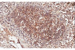 Immunohistochemistry (IHC) image for anti-Growth Factor Receptor-Bound Protein 2 (GRB2) (C-Term) antibody (ABIN184670)