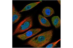 Image no. 1 for anti-Interleukin 6 (IL6) antibody (ABIN181728) (IL-6 Antikörper)
