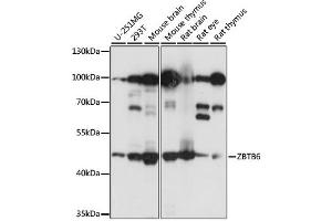 Western blot analysis of extracts of various cell lines, using ZBTB6 antibody.