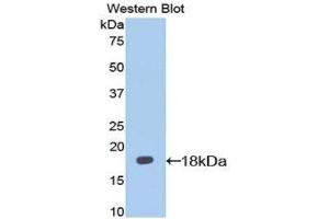 Western Blotting (WB) image for anti-Interleukin 13 Receptor, alpha 1 (IL13RA1) (AA 28-171) antibody (ABIN1174862) (IL13 Receptor alpha 1 Antikörper  (AA 28-171))