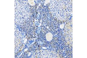 Immunohistochemistry of paraffin-embedded rat ovary using MYOG antibody.