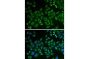Immunofluorescence analysis of HeLa cell using SMPD1 antibody.