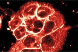 Immunofluorescent staining of A431 cells. (P-Cadherin Antikörper  (AA 72-259))