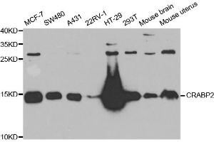 Western blot analysis of extracts of various cell lines, using CRABP2 antibody (ABIN5973604) at 1/1000 dilution. (CRABP2 Antikörper)