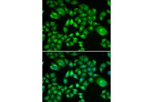 Immunofluorescence analysis of A549 cells using H6PD antibody. (Glucose-6-Phosphate Dehydrogenase Antikörper)