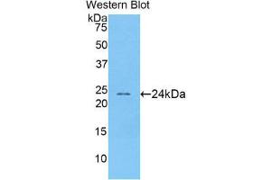 Western Blotting (WB) image for anti-Acetylcholinesterase (AChE) (AA 123-334) antibody (ABIN1174625) (Acetylcholinesterase Antikörper  (AA 123-334))