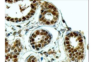 ABIN184704 (4µg/ml) staining of paraffin embedded Human Breast. (APEX1 Antikörper  (N-Term))