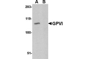 Western Blotting (WB) image for anti-Glycoprotein VI (Platelet) (GP6) (C-Term) antibody (ABIN1030419) (GP6 Antikörper  (C-Term))