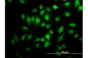 Immunofluorescence of monoclonal antibody to EHD2 on HeLa cell. (EHD2 Antikörper  (AA 365-427))