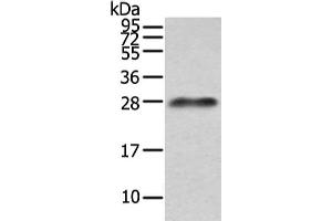 Gel: 12 % SDS-PAGE, Lysate: 40 μg, Lane: Human plasma solution, Primary antibody: ABIN7191260(Lambda Light chain Antibody) at dilution 1/200 dilution, Secondary antibody: Goat anti rabbit IgG at 1/8000 dilution, Exposure time: 10 seconds (IGLV1-51 Antikörper)