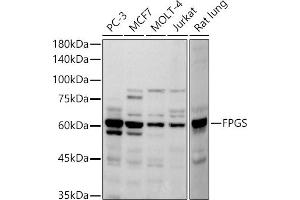 Western blot analysis of extracts of various cell lines, using FPGS antibody (ABIN7267230) at 1:500 dilution. (FPGS Antikörper)