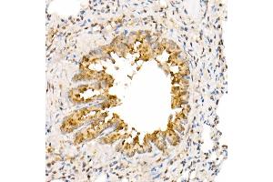 Immunohistochemistry of paraffin-embedded rat lung using  Rabbit pAb (ABIN7265581) at dilution of 1:350 (40x lens). (ANAPC2 Antikörper  (AA 400-500))