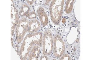 Immunohistochemistry (IHC) image for anti-Amyloid beta (A4) Precursor Protein (APP) (pThr668) antibody (ABIN6255723)