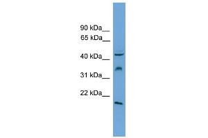 WB Suggested Anti-DUSP5 Antibody Titration: 0. (DUSP5 Antikörper  (Middle Region))